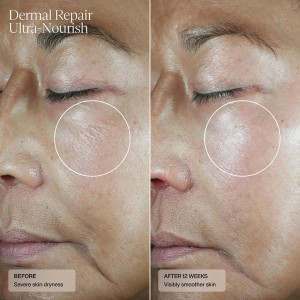 Dermal Repair Ultra- Nourish - RegimenPro®