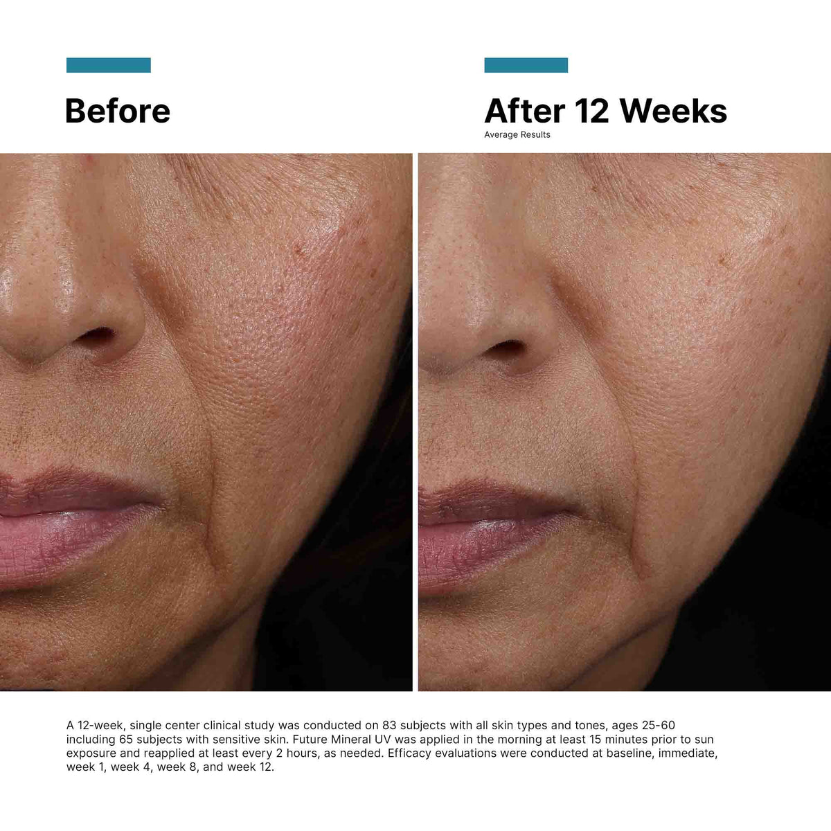 SkinCeuticals Future Mineral UV Defense SPF 50 before and after