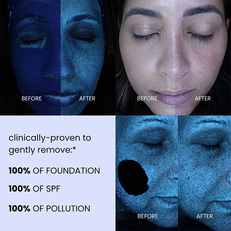 Dr. Whitney Bowe Bowe Glowe Cleanser 3.9 oz/120ml before and after