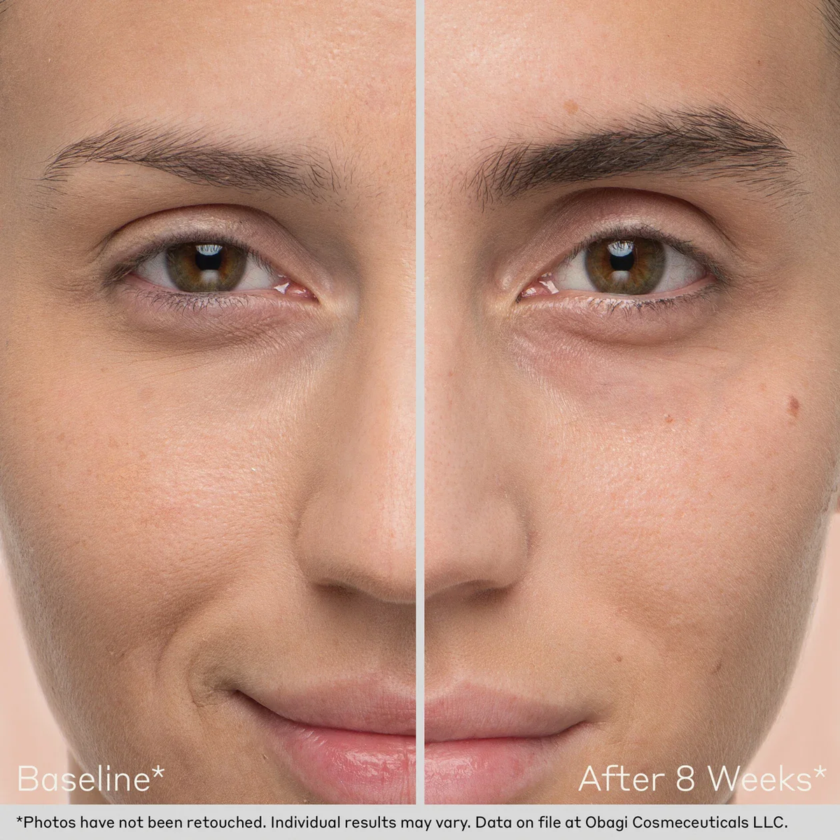 before and after photo of model's eyebrows after using Obagi Nu-Cil Brow for 8 weeks. Model has significantly fuller brows.