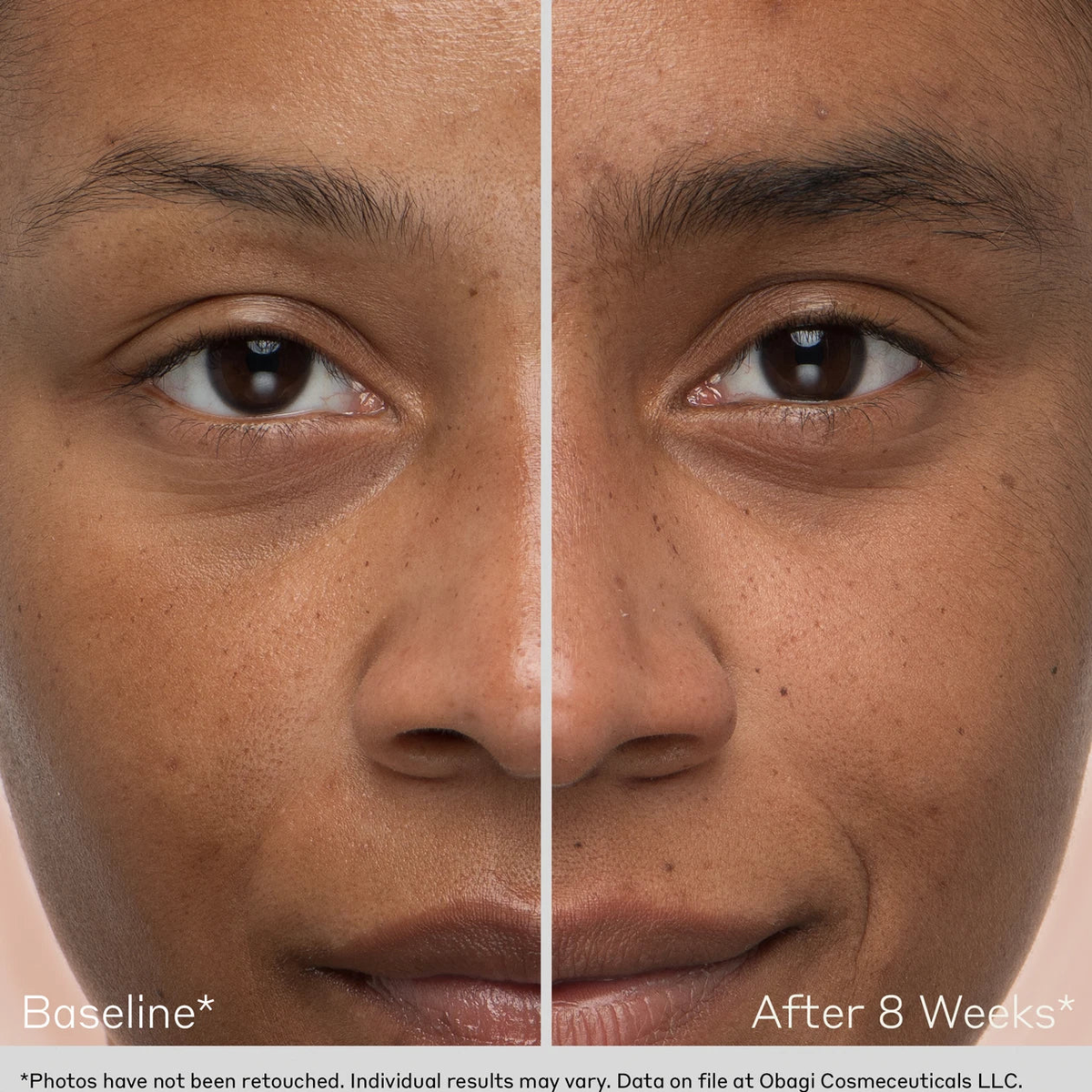 before and after photo of model's eyebrows after using Obagi Nu-Cil Brow for 8 weeks. Model has significantly fuller brows.