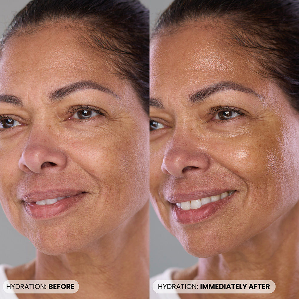 Dr. Whitney Bowe Beauty P46 Refill before and after