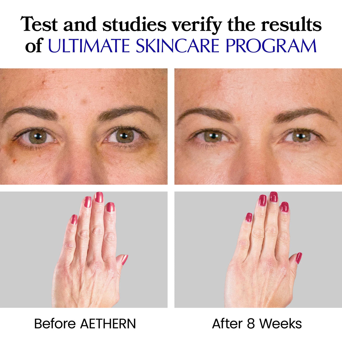 Aethern Ultimate Skincare Program box, 30 day supply before and after results, 8 week study
