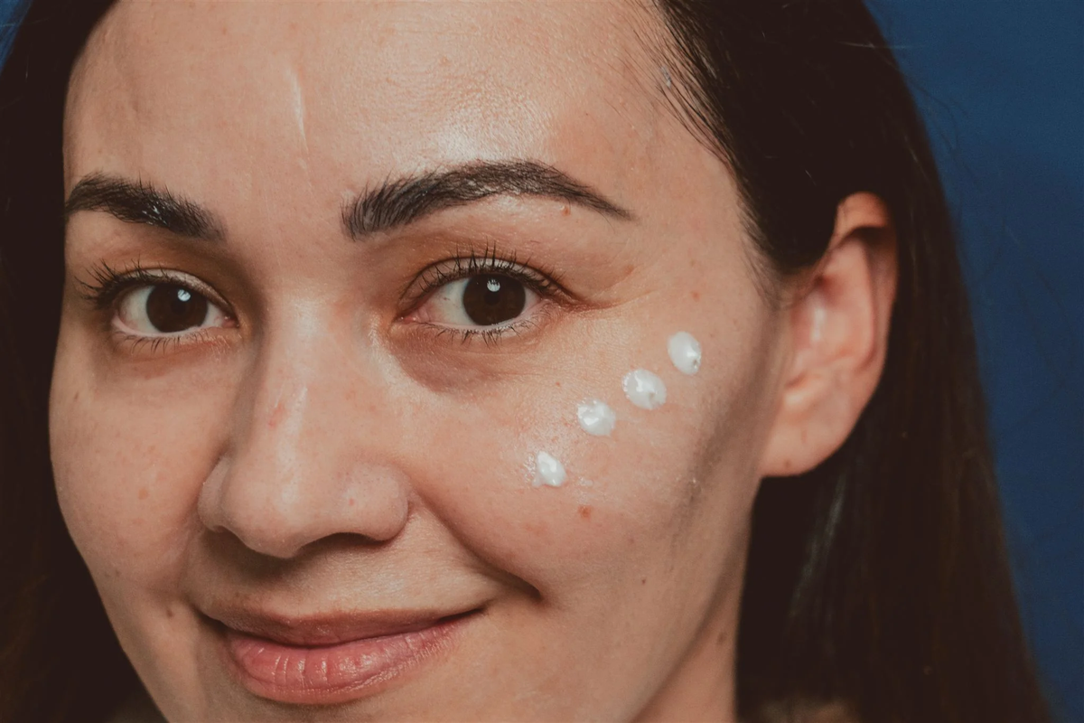 Dermasensa UV-X Mineral Sunscreen SPF 40 Non-Tinted, 1.75oz dots of sunscreen on the cheek