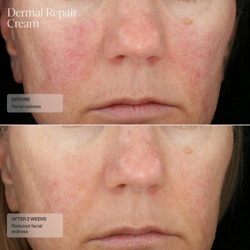 Sente Dermal Repair Cream 50 ml / 1.7 US fl oz Results