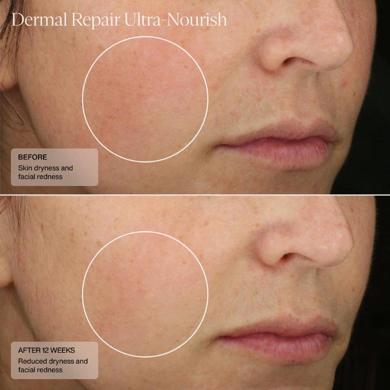 Sente Dermal Repair Ultra- Nourish 50 ml / 1.7 US fl oz results