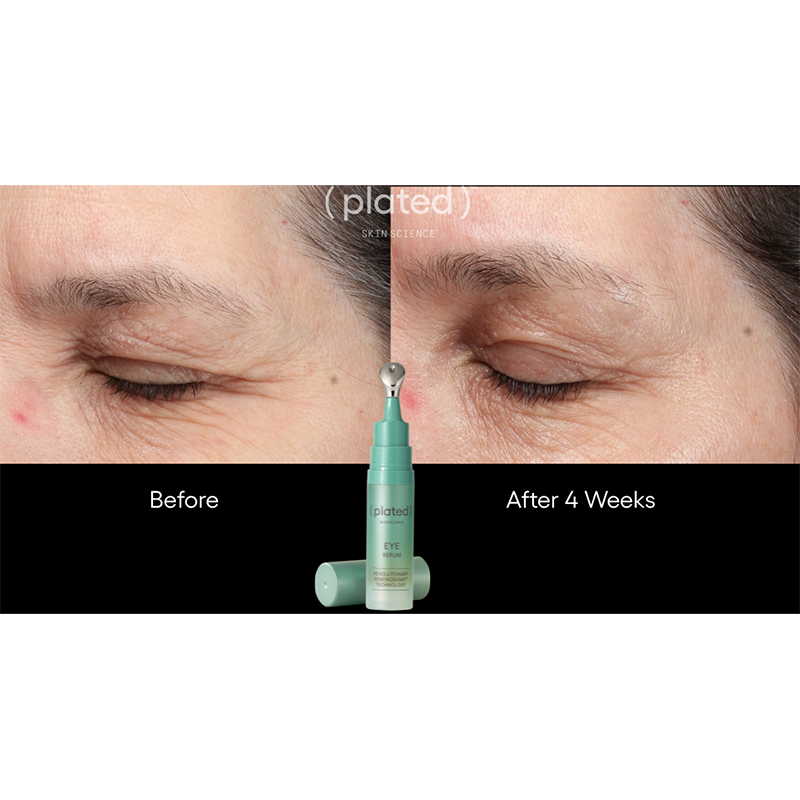 EYE Serum - RegimenPro® EYE Serum - RegimenPro®