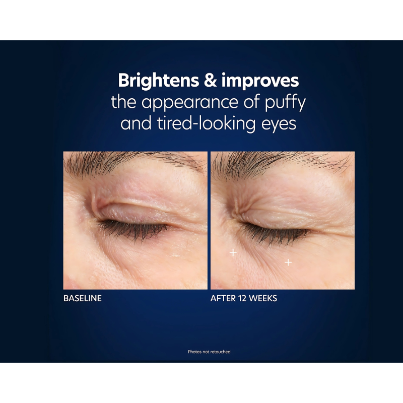 PCA skin Hyaluronic Acid Microneedle Eye Patch 4 treatments brightens and improves