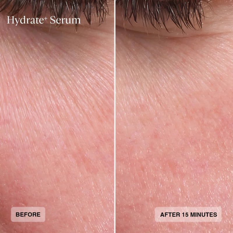 Sente Hydrate+ Serum 30 ml / 1 US fl oz before and after