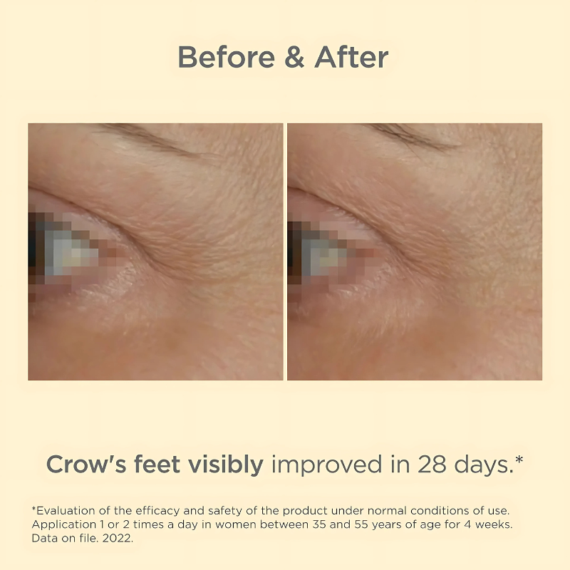 ISDIN Vital Eyes 15 g before and after