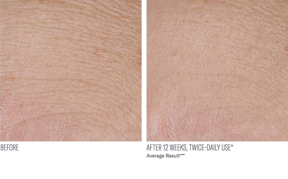 Interfuse Treatment Cream FACE and NECK before and after, 12 weeks