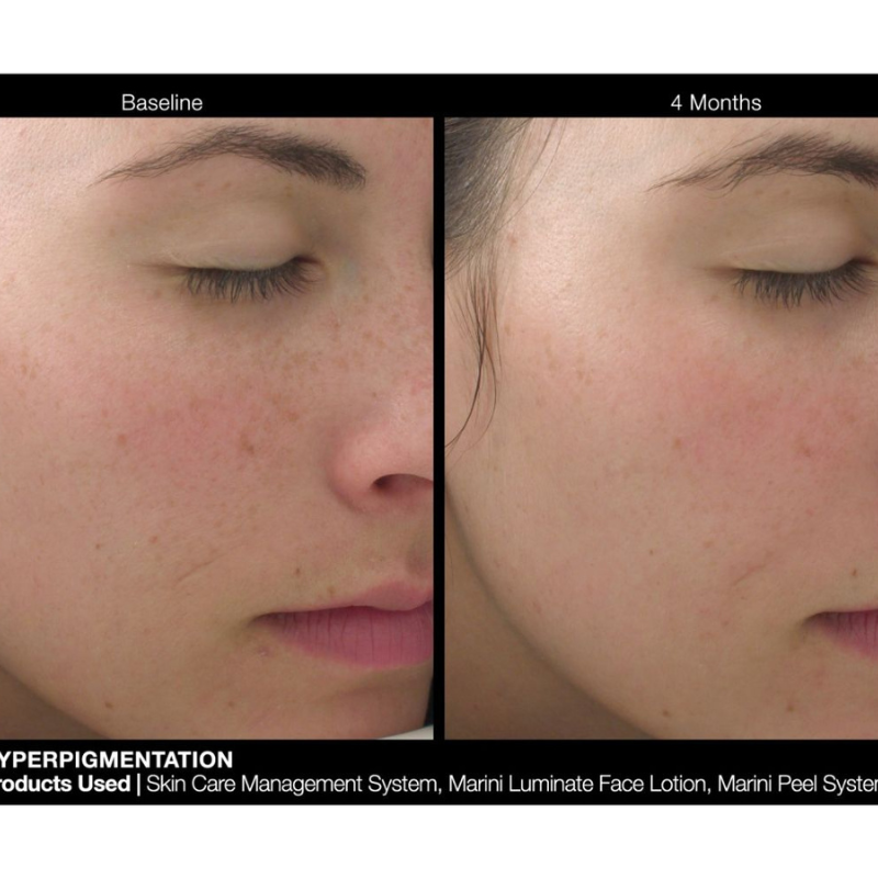 Jan Marini Luminate Face Lotion results