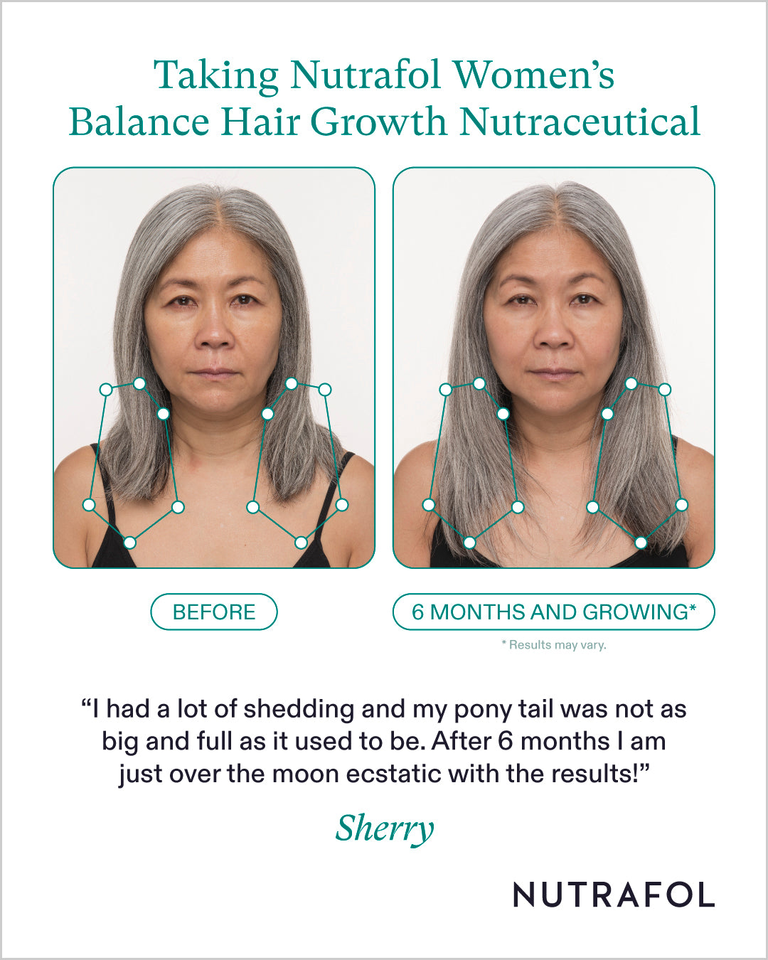 Nutrafol Women's Balance before and after