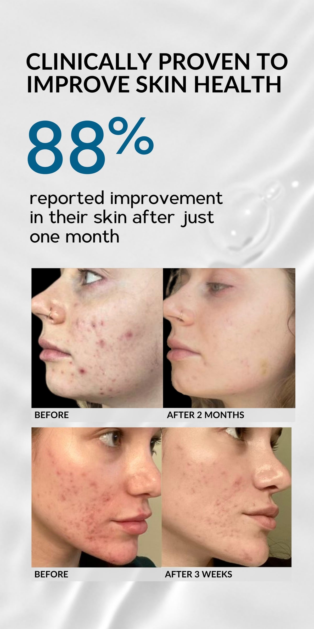 AO2 Skin - RegimenPro®