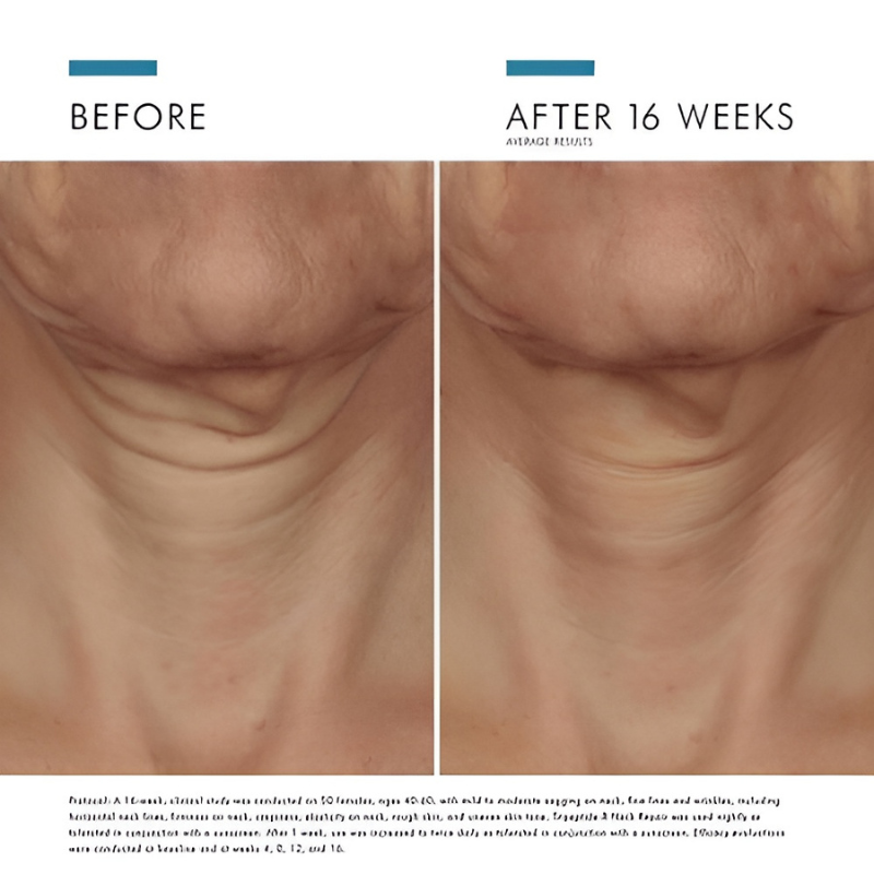 SkinCeuticals Tripeptide-R Neck Repair 50 ml / 1.7 fl oz before and after 16 weeks