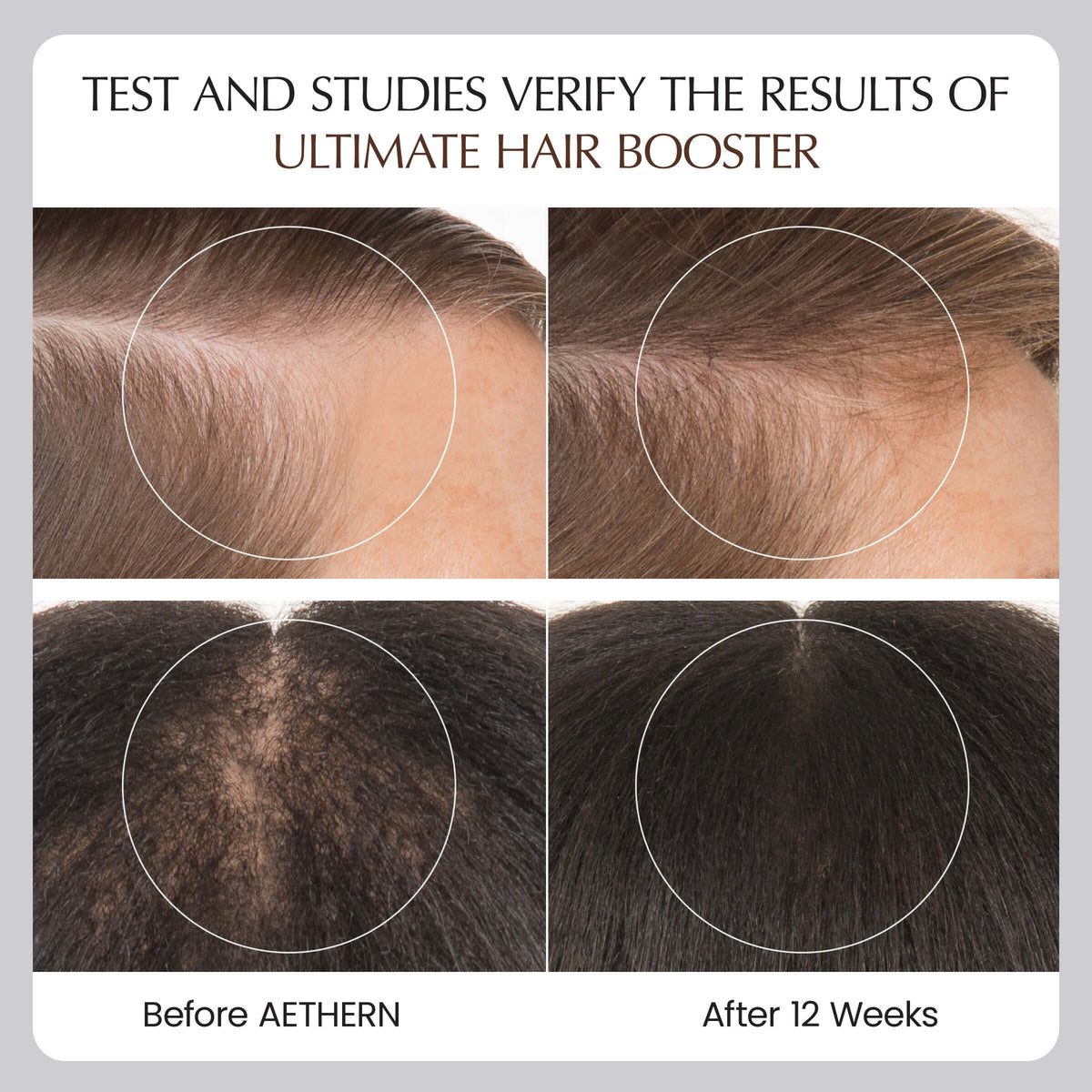 Before and after results of Aethern hair booster on hair growth.