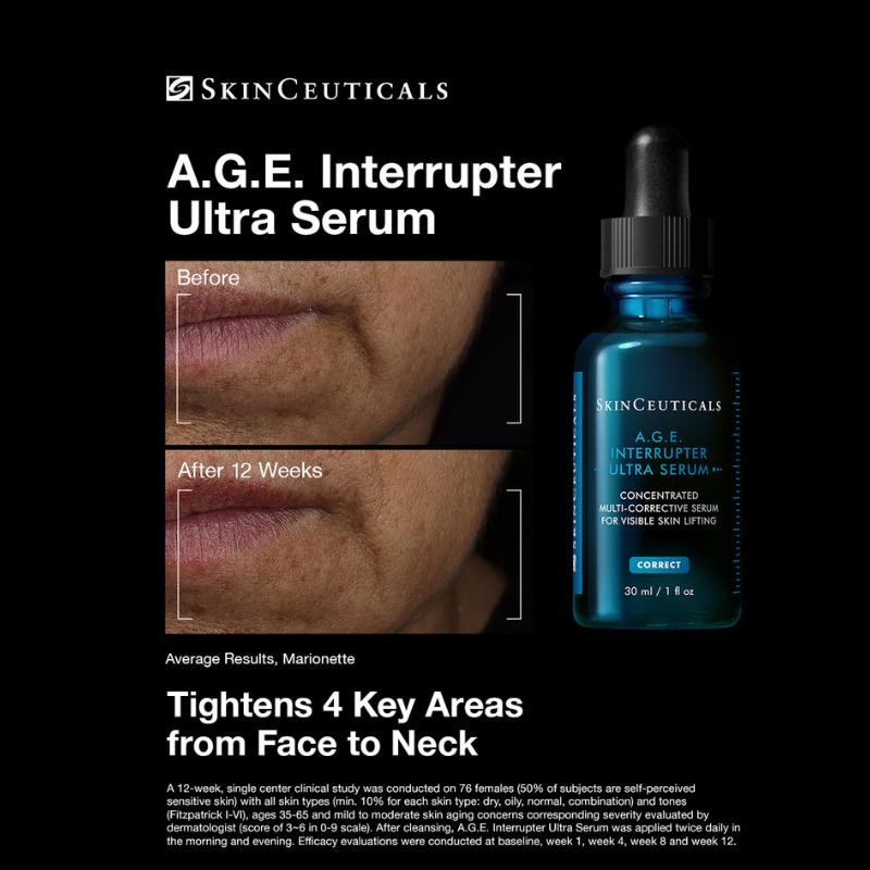 SkinCeuticals A.G.E. Interrupter Ultra Serum with before and after skin comparison on a black background.