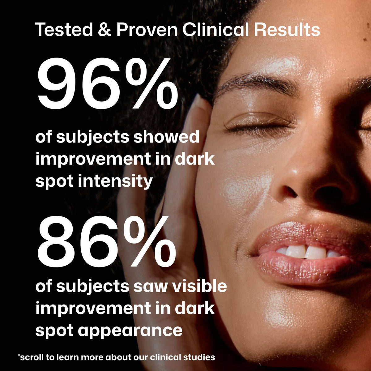 Revision Skincare Advanced Pigment Corrector+ clinical data