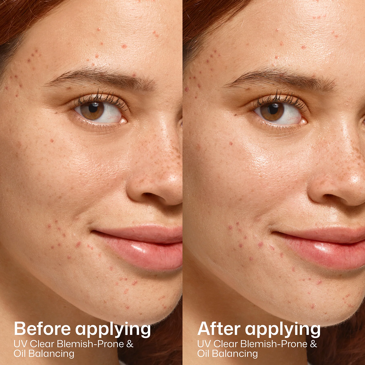 EltaMD UV Clear Blemish-Prone & Oil Balancing Broad Spectrum SPF 50. 1.7oz/48g size before and after application