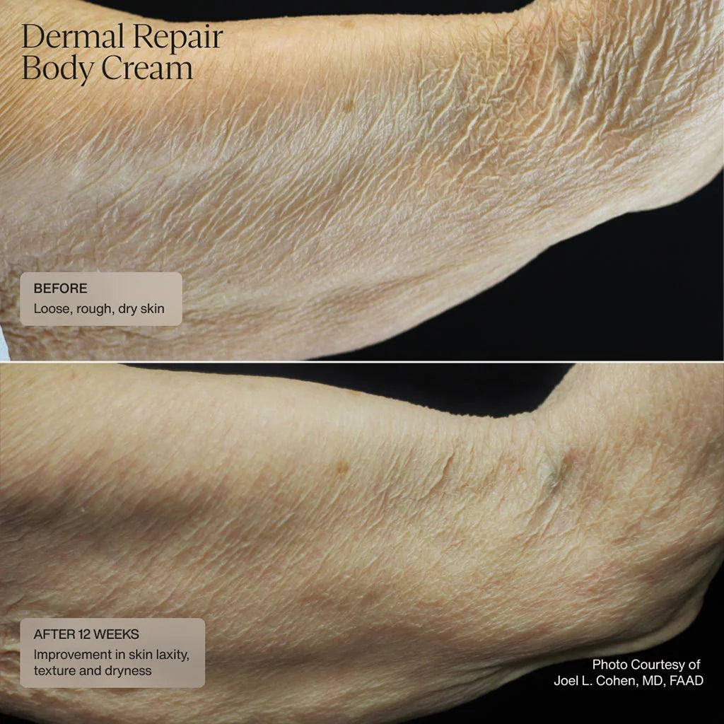 Dermal Repair Body Cream