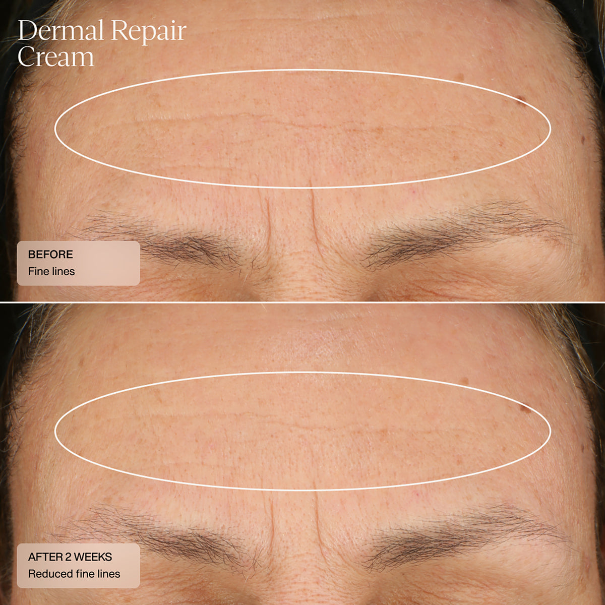 Dermal Repair Cream 50 ML