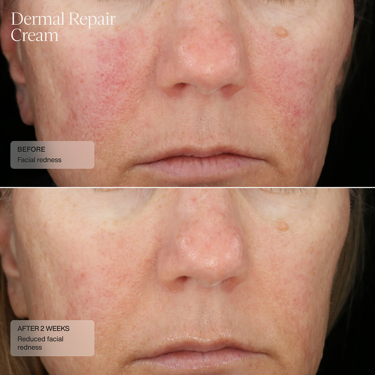 Dermal Repair Cream