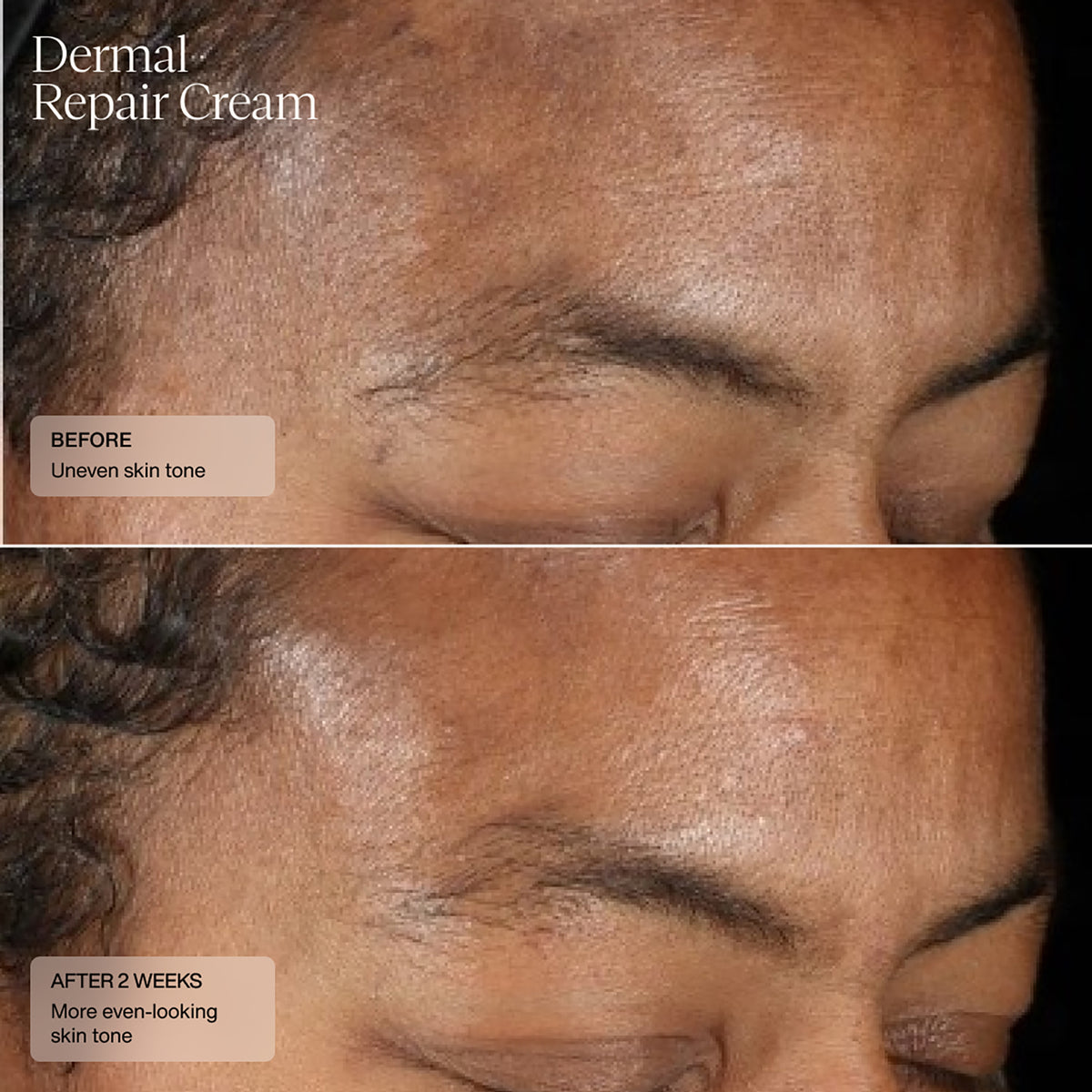 Dermal Repair Cream