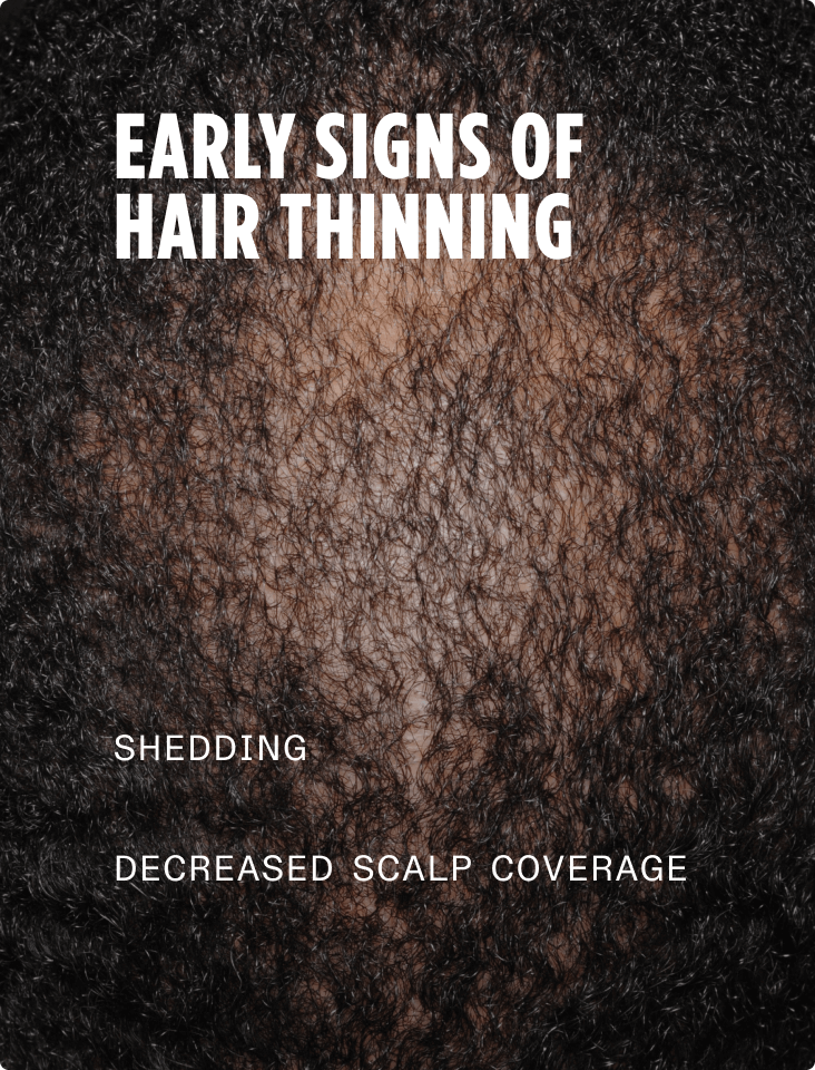 Early signs of hair thinning