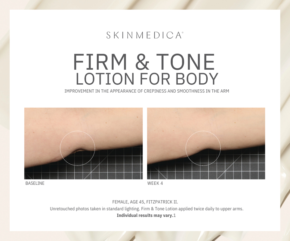 SkinMedica Firm & Tone Lotion for Body before and after image #1