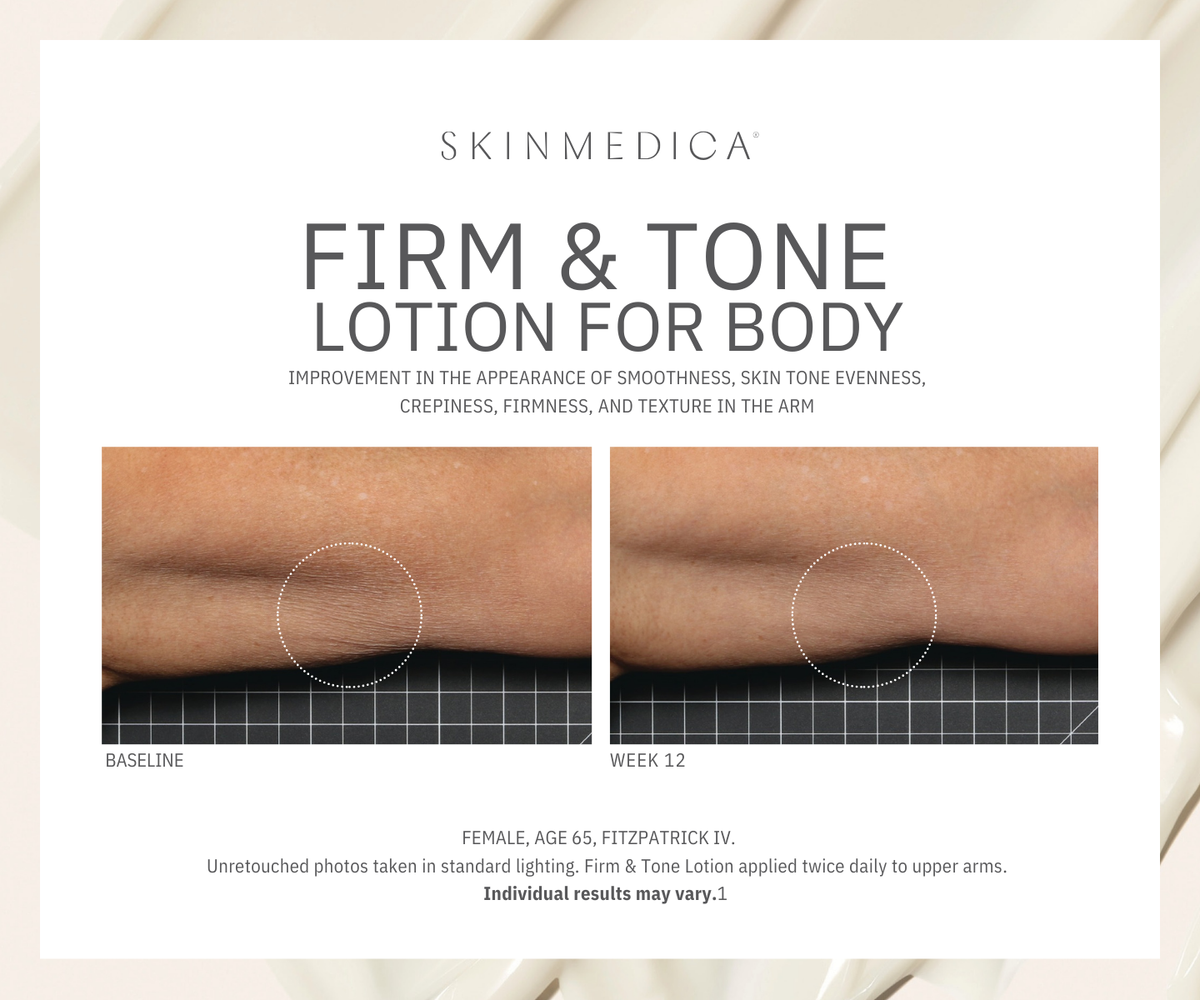 SkinMedica Firm & Tone Lotion for Body before and after image #2
