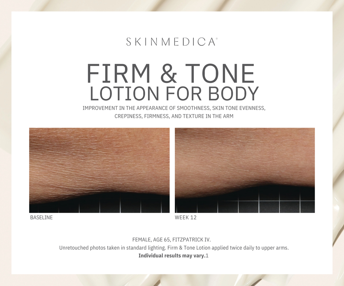 SkinMedica Firm & Tone Lotion for Body before and after image #3